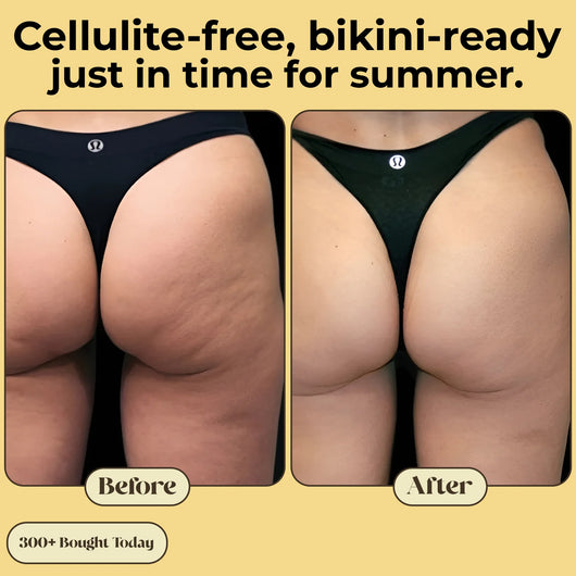 Serouna® Anti-Cellulite Massage Oil