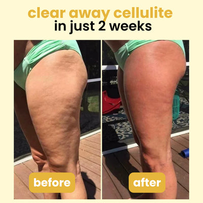 Serouna® Anti-Cellulite Massage Oil