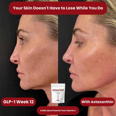 Serouna® Astaxanthin Softgels for GLP-1 Skin Support