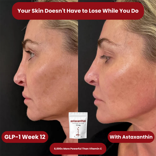 Serouna® Astaxanthin Softgels for GLP-1 Skin Support