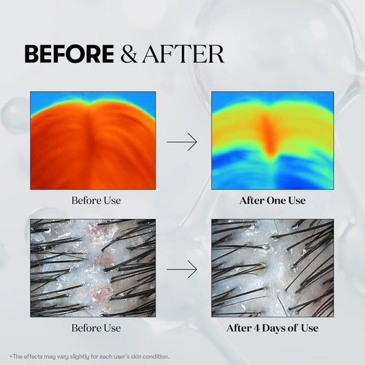 Serouna™ Hair Revival Ampoule