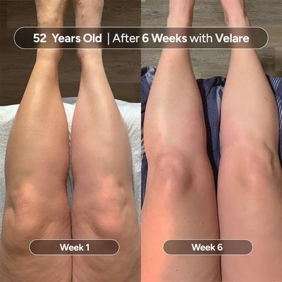 Serouna® Anti-Cellulite Massage Oil